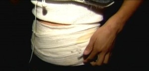 Fernando in bandages